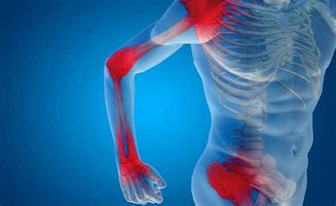 Treatment For Arthritis And Joint Pain – Preserva Wellness