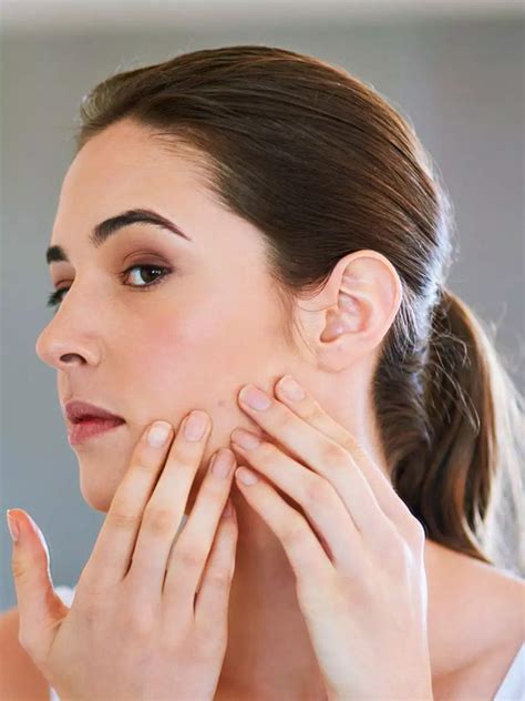 Best natural ways to fight pimples | EconomicTimes