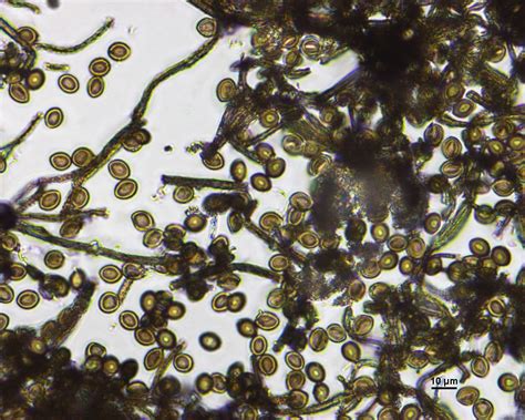 Household Mould Under a Microscope! - Mould & Air Quality Testing ...