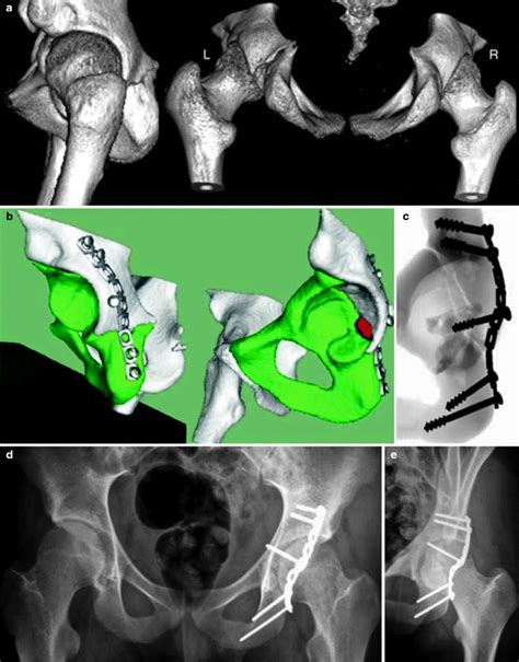 Image result for Surgery Simulation