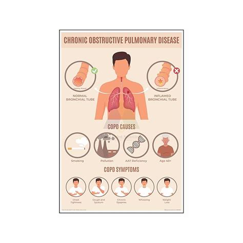 Anne Print Solutions® Chronic obstructive pulmonary disease Posters ...