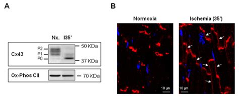 Connexins in the Heart: Regulation, Function and Involvement in Cardiac ...