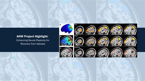 Image result for Aphasie Recovery