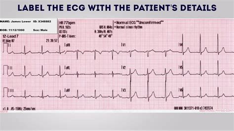 How to Record an ECG - OSCE Guide | Procedure | Geeky Medics