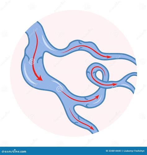 Varicose Veins. Blue Blood Vessel Visible through the Skin. Vascular Disease Diagnostic and ... - treat venous disease