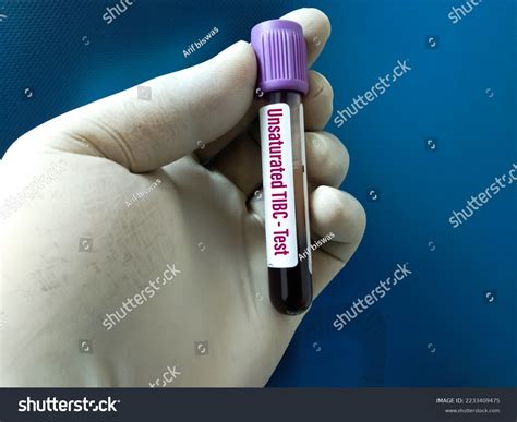 Blood Sample Unsaturated Ironbinding Capacity Uibc Stock Photo ...