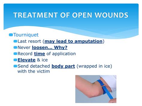 PPT - BLEEDING PowerPoint Presentation, free download - ID:1182084