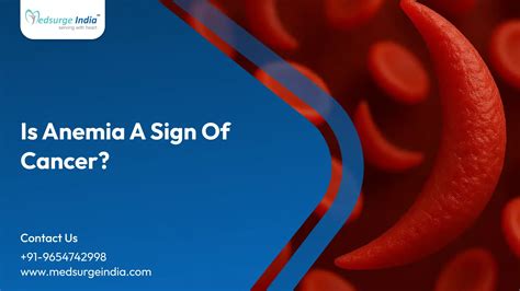 Sindrome di Sjögren: sintomi, cause e trattamento