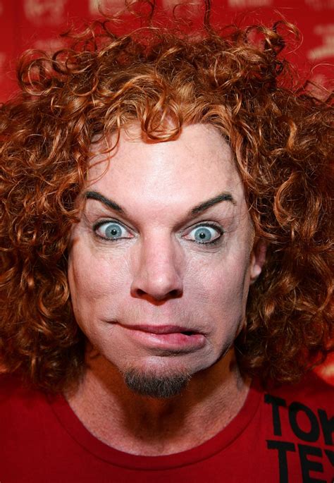 Carrot Top Surgery Gone Bad