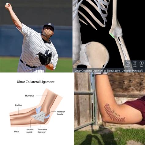 Tommy John Elbow Injury Top Sellers | www.jkuat.ac.ke