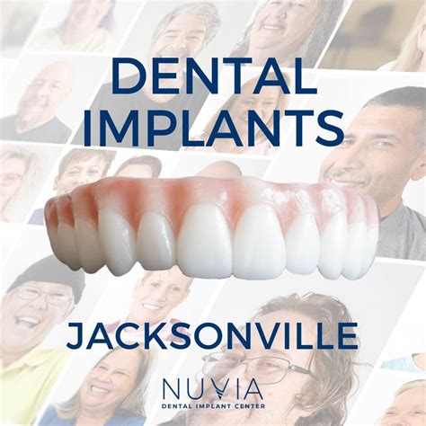 Nuvia Dental Implant Centers in Florida