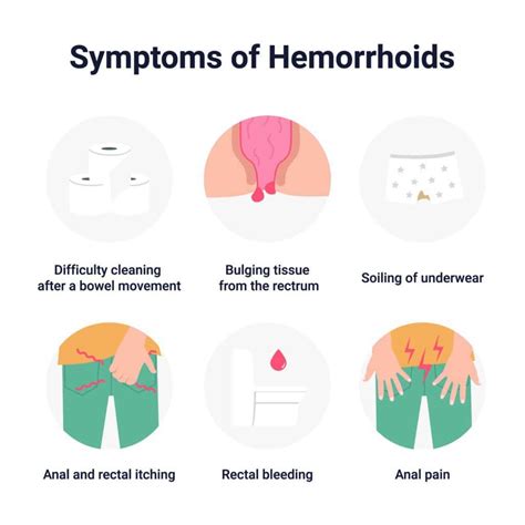 Piles (Haemorrhoids) - Causes, Symptoms, Risk Factors & Treatment | CK ...