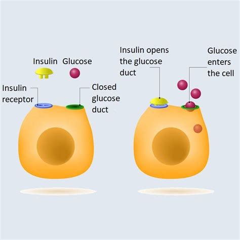 Image result for Insulin Management Algorithm