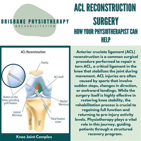 ACL Reconstruction surgery - Brisbane Physiotherapy & Podiatry