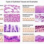 epithelial 的图像结果