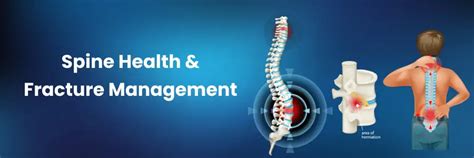 Advanced Spine Health & Fracture Care in Begumpet at Medicover