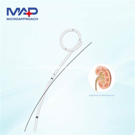 Medical Ureter Stent with Guide Wire - Stent Sets and Urological Sent