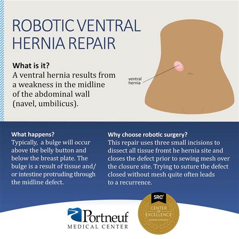 Hernia Repair Procedures - Idaho Hernia Center