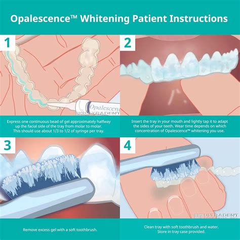 Teeth Whitening Gel Instructions at Otto Atkinson blog