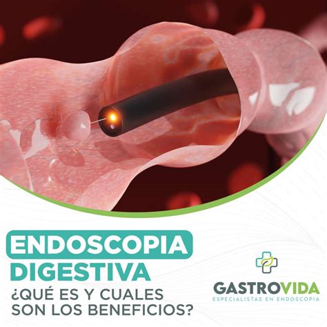 ¿Qué es la Endoscopia Digestiva y cuáles son sus Beneficios?