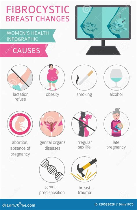 Fibrocystic Breast Changes Disease, Medical Infographic. Diagnostics, Symptoms, Treatment Stock ...