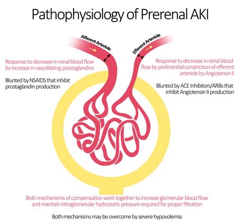 Uremia Vs Azotemia