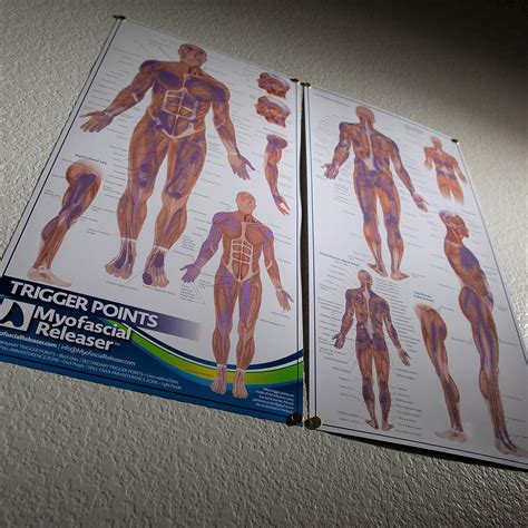Triggerpoint Anatomy Card - Essential Office Work Poster for Massage Therapists Physiotherapists ...