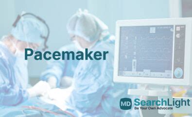 Image result for Installing Pacemaker