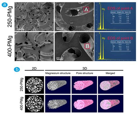 Bone Regeneration Induced by Patient-Adapted Mg Alloy-Based Scaffolds ...
