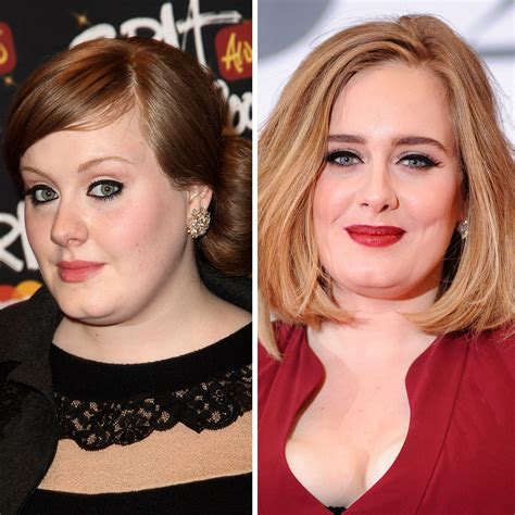 Adele Before And After
