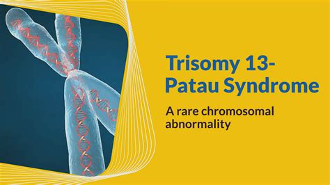 Trisomy 13- a rare genetic condition