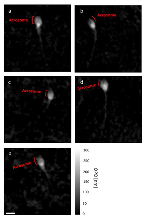 Sperm Inspection for In Vitro Fertilization via Self-Assembled ...