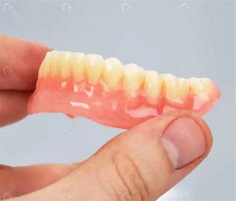 宁波全口假牙大概需要多少费用?种植牙/吸附性义齿价格公布,种植牙-8682赴韩整形网