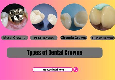 Choosing The Best Type Of Dental Crown For Your Smile In 2026