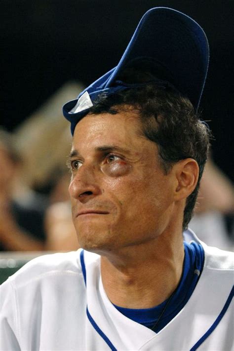 Bildergebnis für politicians and celebrities with black eyes