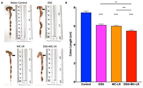 Exposure to the Harmful Algal Bloom (HAB) Toxin Microcystin-LR (MC-LR ...