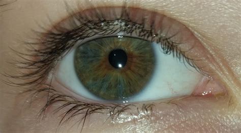 Does anyone know how rare partial heterochromia is? As rare as complete ...