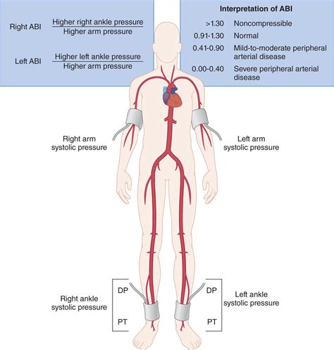 Image result for Prior Learning Examples
