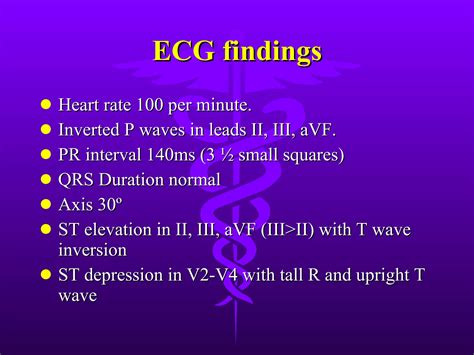 ECG: Coronary Sinus Rhythm | PPT
