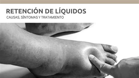Retencion De Liquidos