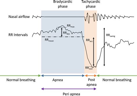 Sleep Apnea Mask Heart Rate at William Foxworth blog