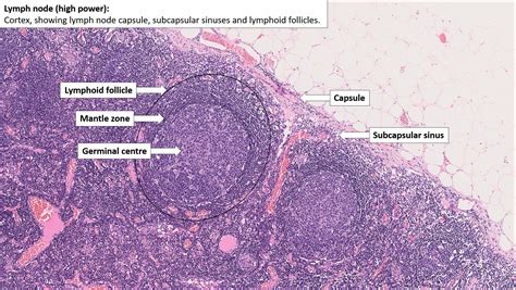 Location of lymph nodes