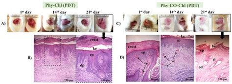 Photo-Phytotherapeutic Gel Composed of Copaifera reticulata ...