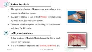 Surface Anesthesia 的图像结果