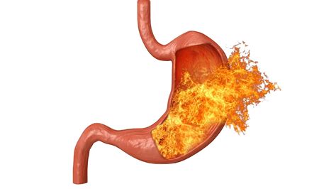 What Causes Burning in the Stomach? – NutritionFact.in