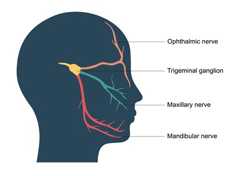 Trigeminal Neuralgia Protocol : Trigeminal neuralgia – OIYRHW
