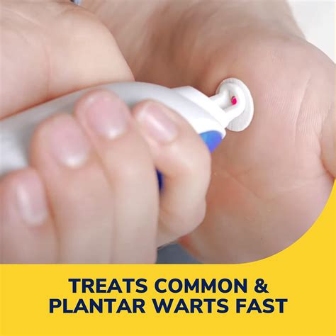 Dr. Scholl's Dr. Scholls Freeze Away MAX Wart Remover - Effective India ...