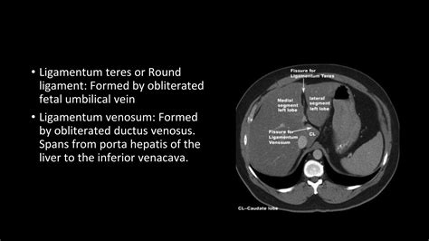 Liver ct anatomy(1).pptx
