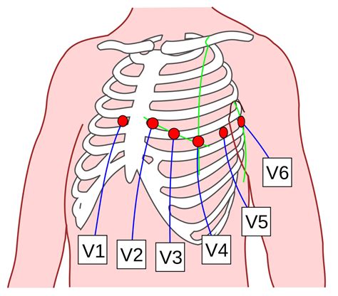 Brustwandableitungen nach Wilson (precordial lead) - DocCheck