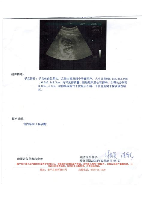 怀孕1-10个月胎儿生长发育指标（附图）_怀孕科普_怀孕_太平洋亲子网